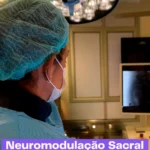 Procedimento de Neuromodulação Sacral