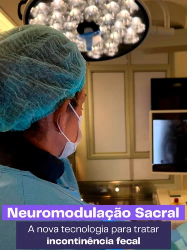 Procedimento de Neuromodulação Sacral